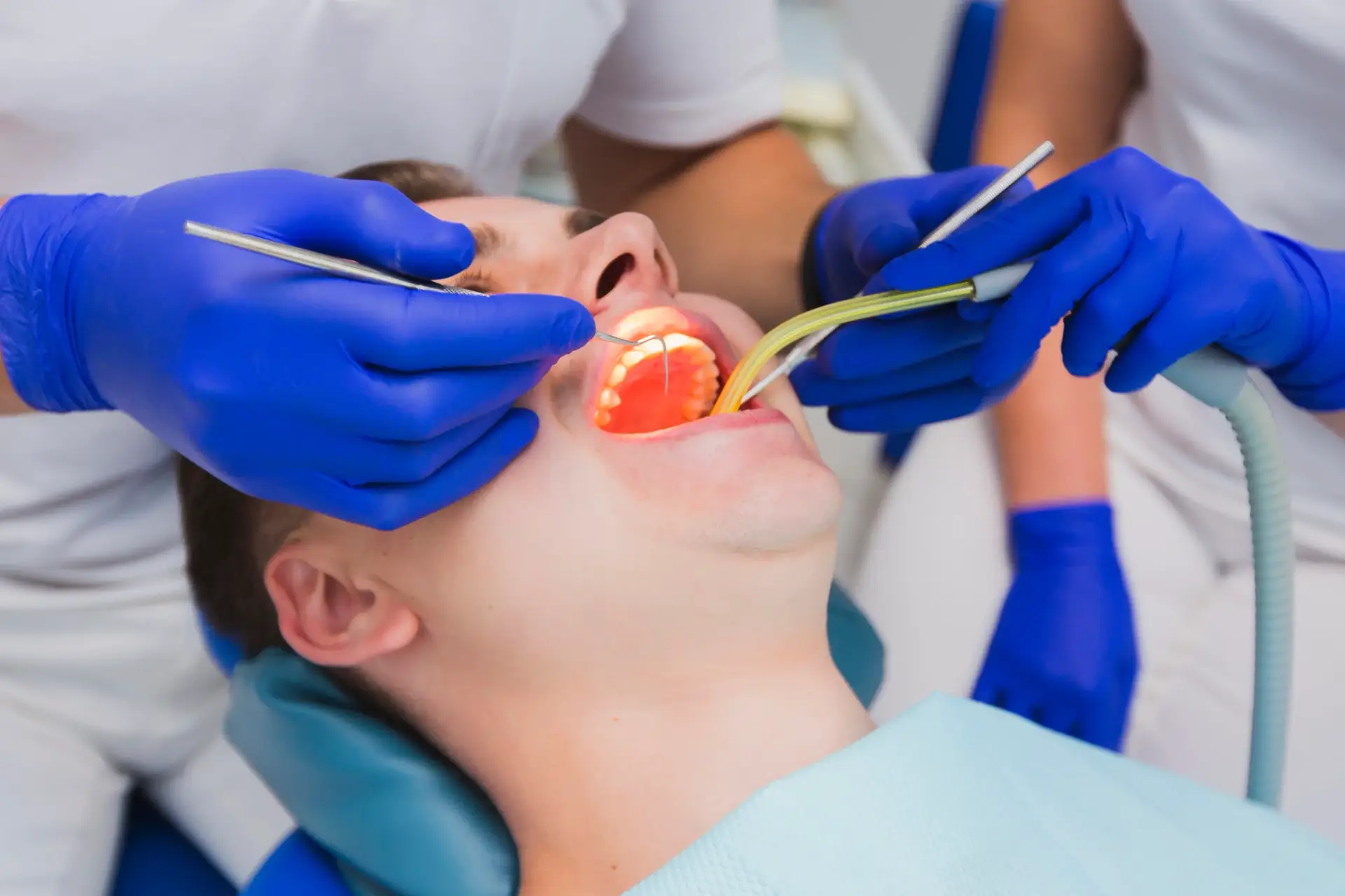 Tooth Extraction: A Step Toward Better Oral Health